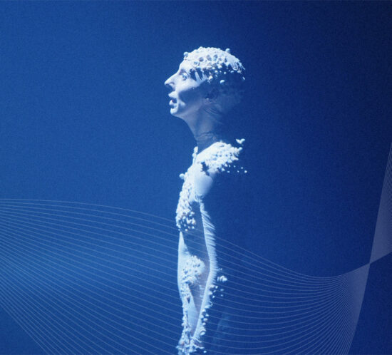 PREMIERE - Dias Abertos em Madrid